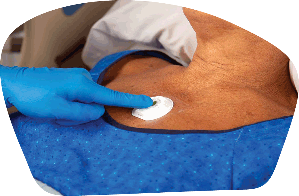 LEAF on patient cheat